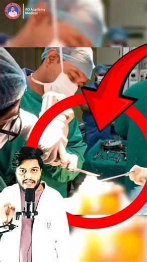How Orthopedic Surgery Fixes Broken Bones 😱 #shorts