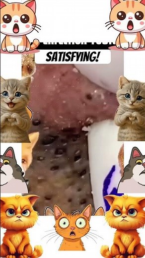 Insane Pimple Popping!!!