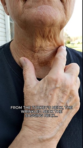 Wrinkled neck and sagging skin? Here's a simple care tip to keep it smooth.22 #wrinkledneck #saggingneck #neckcare #healthyskin #skincaretips