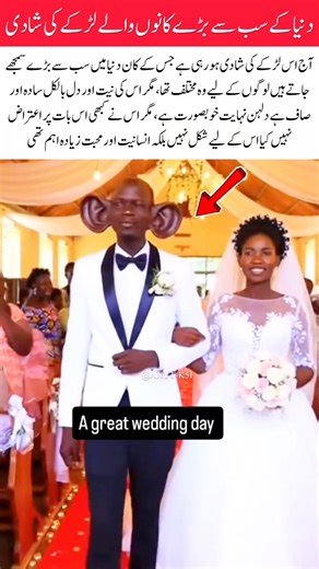 The Man With the World’s Biggest Ears Found Love That Truly Accepted Him #foryou #trending #marriage
