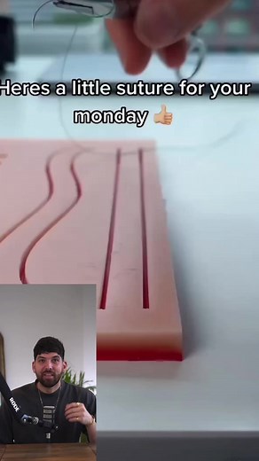 Stitches and Staples on Stomach - Dr. Adam Goodcoff