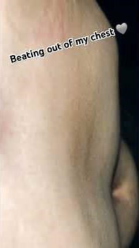 Very Visible Heartbeat Throbbing