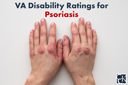 Psoriasis VA Disability Ratings and Benefits Explained | CCK Law