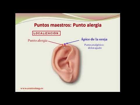 57 Allergy Master point. Auriculotherapy courses. IMG Center