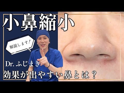 【鼻整形】小鼻縮小術で効果が出やすい鼻って？【解説：ふじまき先生、美容外科専門医、湘南美容クリニック東京秋葉原院】