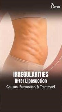 Hard Areas & Lumps After Liposuction | Is It Normal? #shortvideo