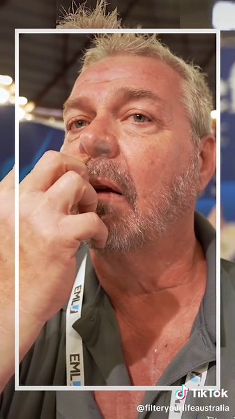 First Defense Nasal Screens: Hypoallergenic Air Filters