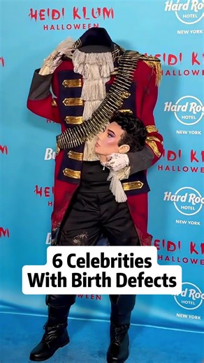 6 celebrities with birth defects #usa #celebrity #defect #movie #hollywood
