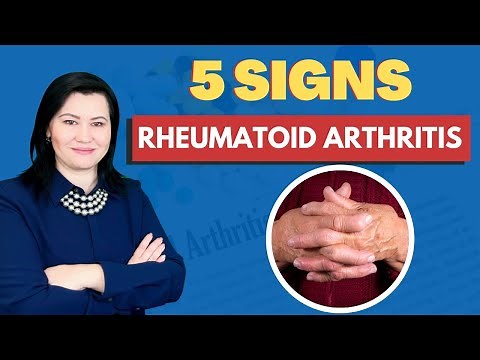 5 Signs of Rheumatoid Arthritis That You Should Not Ignore