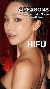 HIFU (high intensity focused ultrasound) targets on SMAS layer on the face and people with mild sagging and heavy facial fats will be the best candidate. 人脸老化，分很多层次。 如果是轻微下垂或脸部脂肪太厚重，你就会很爱超声刀/超声泡/音波 的效果。 如果是韧带下垂，或缺乏面部脂肪，或皮松，或骨骼收缩流失，或严重下垂者，那HIFU 会让你失望哦。要理解你是属于哪一类型吗？ WhatsApp 我们做个咨询吧，让医生帮你评估。#aestheticclinicmalaysia #aestheticclinickl #马来西亚医美 #马来西亚微整形 #马来西亚微整 | Rachelchewclinic