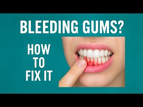 Bleeding Gums? Here's What It Means & How to Fix It