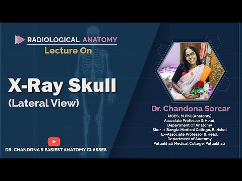 Lecture On X-Ray Skull (lateral view)