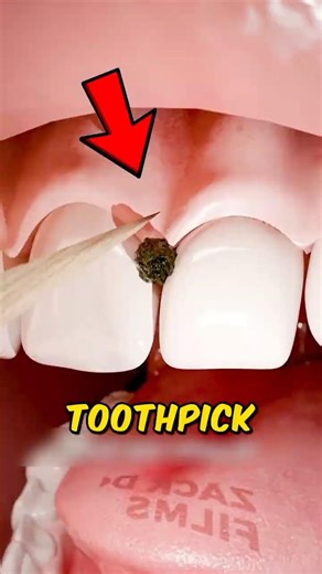 👉 “If You’re Using Toothpicks Like This… Stop Now 😳”