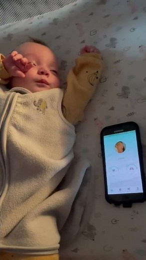 Infant Spasms or reflexes?