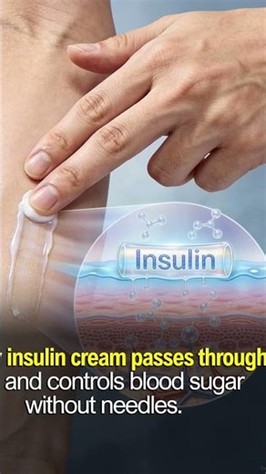 insulin cream invented that passes skin and control blood sugar level.