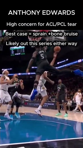 Anthony Edwards injury - high concern for ACL, PCL tear. Even best case prob sidelines him #nba