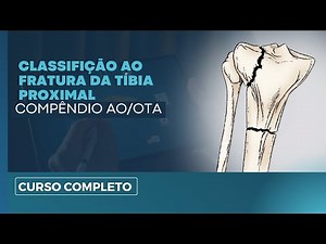 Understand the AO Classification of Proximal Tibial Fractures | Orthopedics Step by Step
