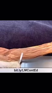 28 reactions | LearnMuscles.com  Excellence-in-education ✨EXTENSOR...
