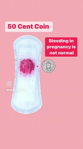 Understanding Bleeding in Pregnancy: Causes and Symptoms