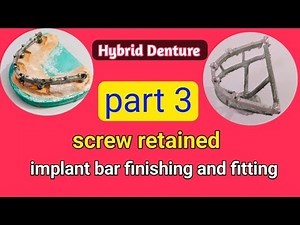 screw retained implant bar finishing and fitting / hybrid denture lab procedure / all on 6 implant