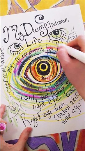 My Left Eye Is A Rebel: My Duane Syndrome Life #duanesyndrome