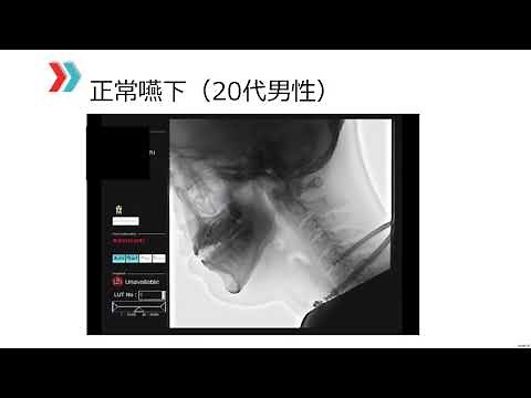嚥下造影検査の見方について 無料視聴動画 （三輪研修会）