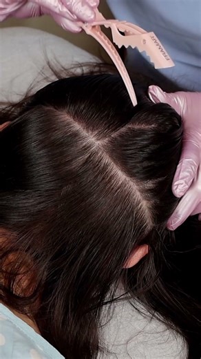 Ultimate ASMR Scalp Inspection with Hair Parting | Manual Skin Check #asmr #short #shorts