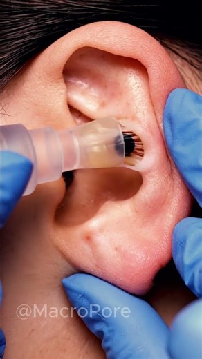 EAR PORE CLEANING at 4K 😮 | Vacuum Blackhead ASMR #asmr #ear #pore