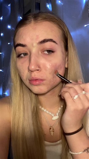 Trying Green Concealer for the First Time | Acne Makeup Tutorial