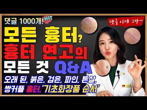 질문답 너무 많아 찍은 흉터 치료, 흉터 연고의 모든 Q&Aㅣ사용 순서, 오래 된, 붉은, 파인 흉터 등등