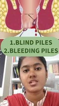Piles After Delivery: When to Worry & When to See a Doctor | Homeopathy Care ⚠️🤱