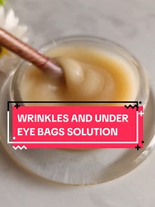 Natural Remedies for Treating Under Eye Wrinkles and Bags
