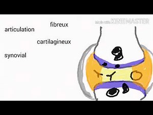 polyarthrite rhumatoide شرح