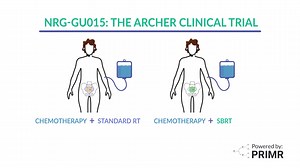 Bladder Cancer Clinical Trial: ARCHER