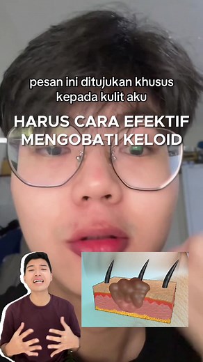 Cara Efektif Menyembuhkan Keloid dan Benjolan Kulit
