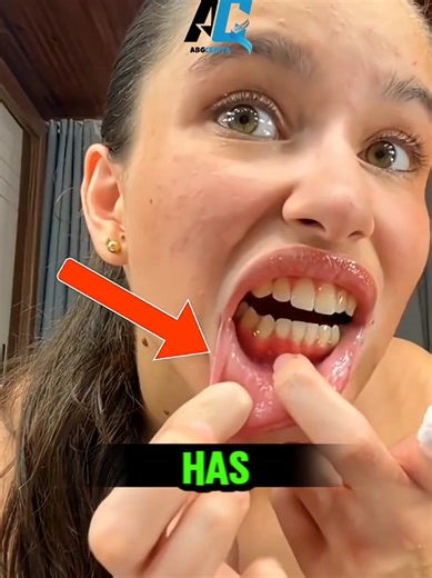 Unexpected Hits: What Happens When You Get Struck?