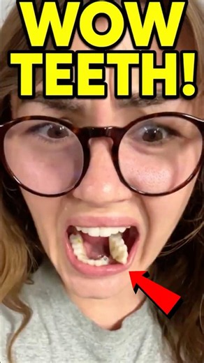 What The Dentist Did Shocked Everyone 😳