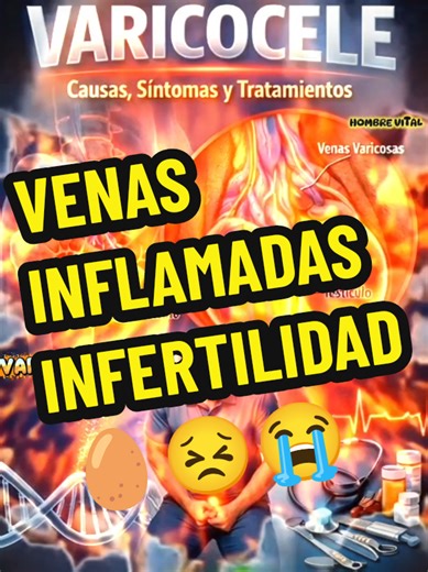 Sufres de VARICOCELE y no solucionas!! #eeuu🇺🇸 #varicocele #infertility #inflamacion #endurezamiento