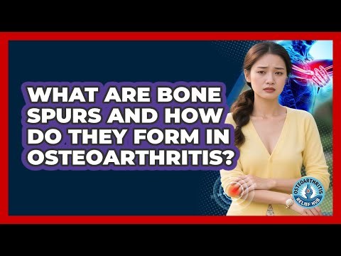 What Are Bone Spurs And How Do They Form In Osteoarthritis? - Osteoarthritis Relief Hub