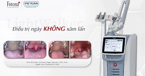 Cải thiện ngủ ngáy với laser LightWalker