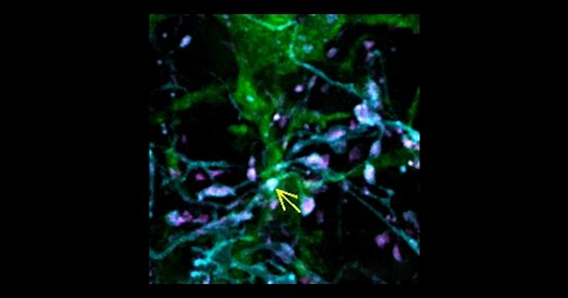 Video catches microglia in the act of synaptic pruning