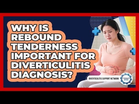 Why Is Rebound Tenderness Important For Diverticulitis Diagnosis? - Diverticulitis Support Network