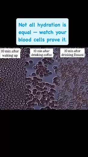 What you’re seeing is real blood under a microscope — before and...