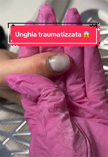 Unghia traumatizzata: recupero e cura dopo sanguinamento