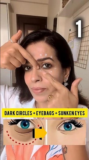 Say Goodbye to Dark Circles & Sunken Eyes! ✨ #FaceYoga #SkincareTips #AntiAging