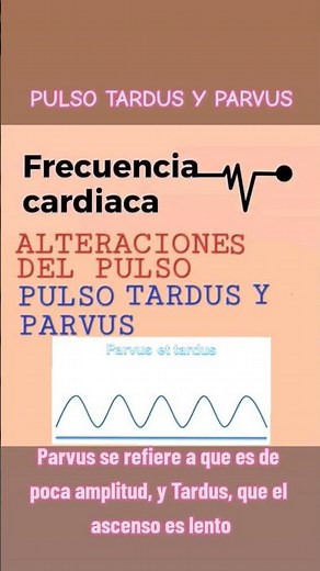 Pulso Tardus y PULSO Parvus #viral #video #medicine #pulso #tardus #parvus