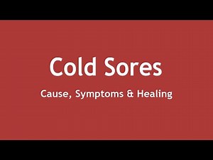 Cold Sores - Cause, Symptoms and Healing [ENGLISH] | Dr. Shikha Parmar