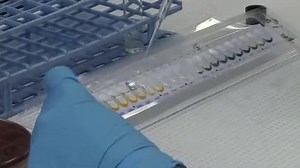 34K views · 613 reactions | Microbiology:API❤️ #microbiology #lablife #medicallaboratory | Lab life | Facebook