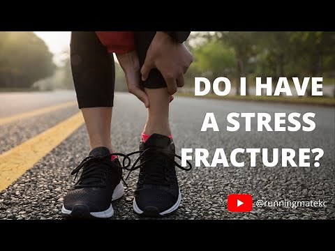 Do I Have A Stress Fracture?