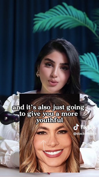 Tear trough filler #fyp #foryou #foryoupage